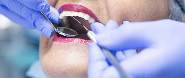 Best Emergency Tooth Extraction in Gig Harbor, WA